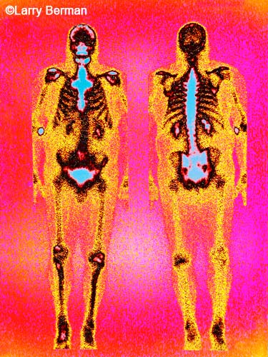 full body scan